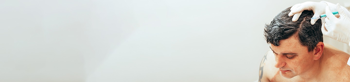 Affordable Hair Transplant & PRP Treatment in Hyderabad – Expert Guide